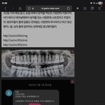 아니