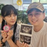 ‘40세 자연임신’ 강은비, 드디어 아들 품는다