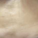 이거 <b>이마</b> 울퉁불퉁? 얼룩덜룩?한 거 왜그런거임