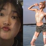 '<b>루푸스</b> 투병' 최준희, 96→41kg 뼈말라 된 후 건강 상태…"면역억제제...