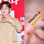 “연예인 <b>화폐</b> 개념 無” 개념 스타 딘딘, 상처 투성이 얼굴 공개→걱정...