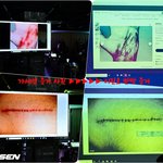 [사진]이진호,'<b>가세연</b> 피습 주장 증거는 구글서 검색되는 이미지...