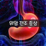 [좋은글] [좋은글] <b>위암</b> 전조 증상