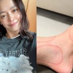 싱글맘 강성연, 子 다친 사고에 분노 “<b>인대</b>에 금 가, 화가 난다”