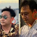 '심정지' 김수용, 주목된 '귓불 <b>전조</b>증상'…알고보니 9년 전에도...