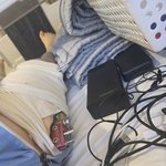 ㅋㅋ 키수술 성형수술다해서 키168->181되고 <b>찐따</b>얼굴에서 <b>훈남</b>됨