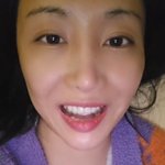 선데이, 서울대까지 찾아가 130만원 <b>짜리</b> “틀니 아닙니다” 치료