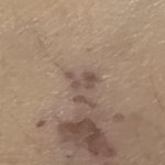 <b>상처</b> 완전 신기하게 생김