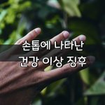 [좋은글] [좋은글] <b>손톱</b>에 나타난 건강 이상 징후