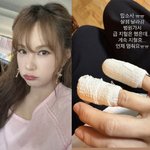 채연, 안타까운 소식 "살점 날아가, 병원 갔지만 <b>지혈</b> 안 돼"