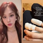 <b>채연</b>, 부상으로 급히 병원行 “살점 날아가, 계속 지혈 중”