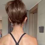 쥬얼리' 이지현, 등에 선명한 백반증…"난치병이지만 매일 <b>씩씩</b>하게"