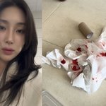 자이언트 핑크, 피 묻은 휴지 사진 공개.."도와주세요"