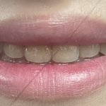 [댓글부탁해] 나 <b>교정</b> 끝났는데 어땡