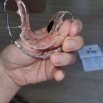 [댓글부탁해] 교정기 유지장치 끼는 사람??