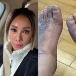 25년차"…김송, 강원래 상태 전했다 "<b>통증</b> 못 느껴" [해시태그]