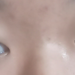 [댓글부탁해] 제발ㅠ <b>눈성형</b> 좀 봐달라고 한사람인데 도와주세요