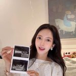 ‘재벌2세 이필립’박현선, 셋째 임신도 모르고 항생제 복용‥지인들...