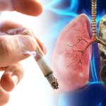 [좋은글] [좋은글] ◇ 흡연율이 낮은 여성의 폐암이 증가하는 이유는...