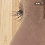 메<b>부리</b>에 웃을때 화살코 스트레스여서