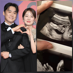 딛고 다시 만난 기적… 6개월 차 <b>초음파</b> 공개 “4개월 뒤 출산”