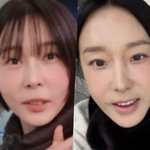 이지혜·강남 이어 김나영까지…확 달라졌다! 솔직한 '시술' 고백