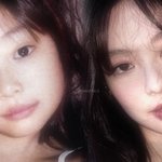 [모두드루와] 성형 잘알 들어와봐 이거 <b>튜닝</b> 좀 한거임?