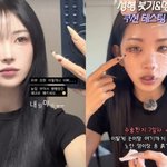 최준희, 또 성형했다..붉게 멍든 눈 <b>리얼</b> 공개 "부기 덜 빠져"