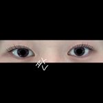 [댓글부탁해] <b>쌍수</b> 2년 반 후기