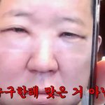 정형돈, 성형 <b>직후</b> 퉁퉁 부은 눈 공개 "일주일 동안 못 나가"