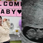 남보라 "자연임신 12주차… <b>태명</b>은 콩알이" [직격인터뷰]