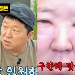 [댓글부탁해] 정형돈, 성형 직후 퉁퉁 부은 모습 공개 "큰 병...