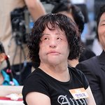 ‘선풍기 아줌마’ 故한혜경, 불법 성형시술로 부작용 겪다 사망…오늘(15일)...