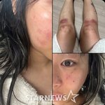 "<b>감금</b>에 부엌 칼..그냥 살고 싶었습니다" AOMG 女래퍼, '데이트...