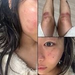 [공식] <b>재키</b>와이, '전 남친' 방달 데이트폭력 폭로..소속사도...