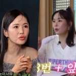 '쌍수3번 고백' 장영란, 또 달라졌다? "수술자국 나올까 걱정"...