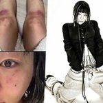 "살기위해" <b>SOS</b>급 '데이트폭력' 피해호소→결국SNS삭제....