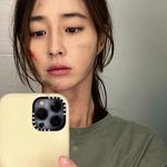 ‘이병헌’ 이민정, 상처난 얼굴 어떡해..꼬질해도 예뻐