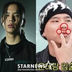 이상..사회공포증 속 고백 "<b>헛구역질</b>하고 토해" [스타이슈]