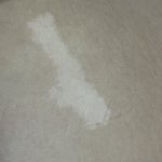 나 허벅지에 <b>이</b> 하얀<b>점</b> 뭐지