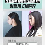 여자는 <b>무턱</b>이 더 사랑스러운듯?