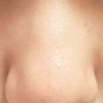 [어케생각해] 애들아 이런 코는 뭐해야함 <b>제발</b> ㅠ