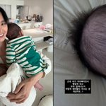 지소연, 쌍둥이 상태에 SOS 요청 “머리 빠지고 <b>두피</b> 일어나”