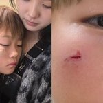 [드루와] 이동국 子, 안타까운 소식…<b>이수진</b> "얼굴 부상에 6바늘...