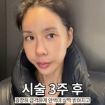 숨기지 않았다…"노화 늦추는 주사 맞아" 고백 (오늘뭐<b>주니</b>)