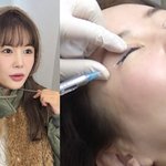  어려진 이유 있었다…또 성형? 눈에 주삿바늘 들어와도 '<b>묵묵</b>'