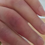 얘들아 밖에나갈때 <b>벌레</b> 물리는거 조심해ㅜ