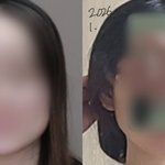 [드루와] 내얼굴형관리<b>전후</b>차이볼사람