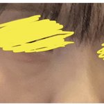 <b>다크</b>서클 너무 스트레스임