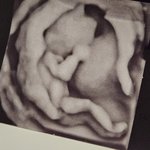 [댓글부탁] 15주 <b>초음파</b> 찍고왔는데